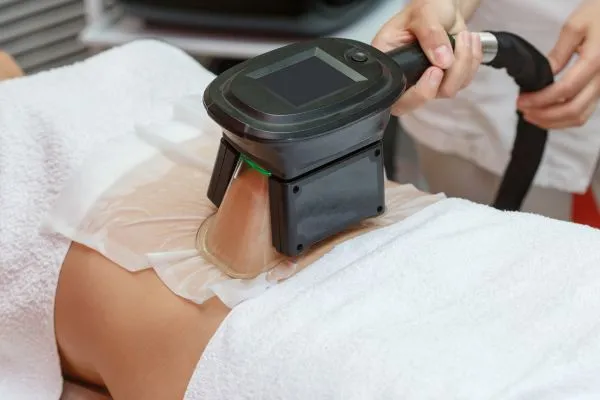 Image of person having fat freezing treatment to help weight gain Walsall Wood