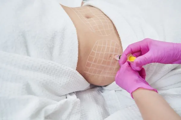 image of fat dissolving injections on love handles to help combat weight gain Walsall Wood