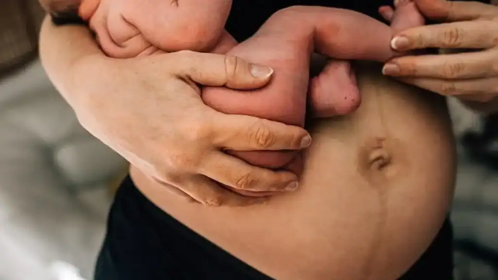 Why Is My Stomach Still Big After Pregnancy Walsall Wood?